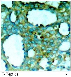 PAK1 (Phospho-Thr212) Antibody