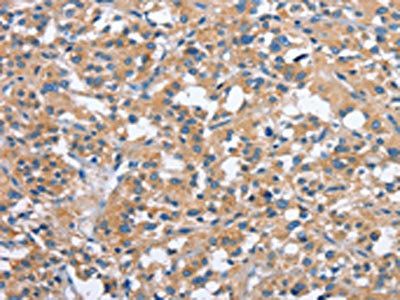 PAK2 Antibody
