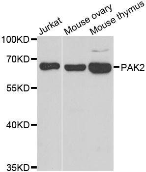 PAK2 antibody
