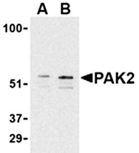PAK2 Antibody