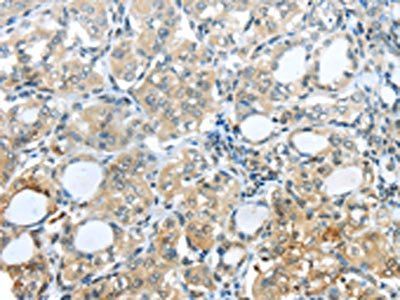 PAK3 Antibody