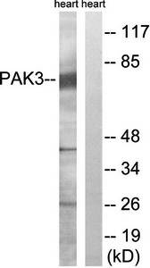 PAK3 antibody