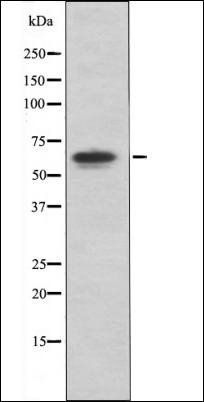 PAK4/5/6 (Phospho-Ser474) antibody