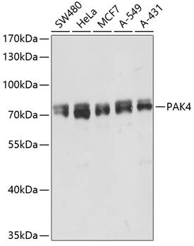 PAK4 antibody