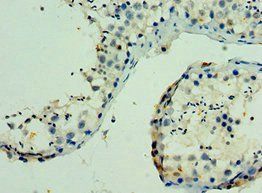 PAK6 Antibody