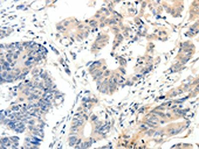 PAK7 Antibody
