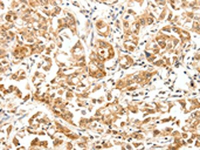 PAK7 Antibody
