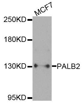 PALB2 antibody
