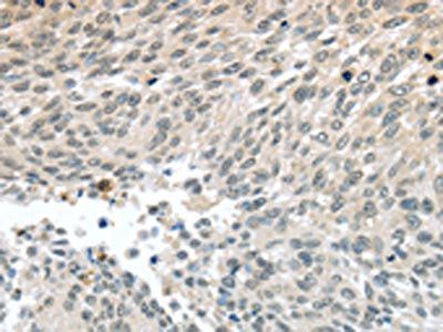 PALB2 antibody