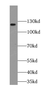 Palladin-Specific antibody