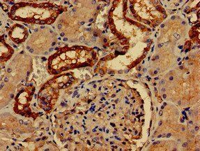 PALM Antibody