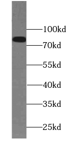 PAMR1 antibody