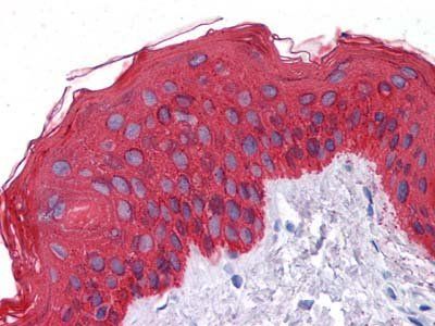 Cytokeratin (Pan) Antibody