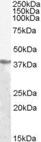 Goat anti-pan ADH Antibody