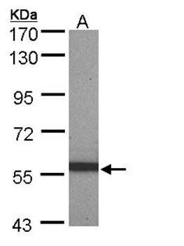 pan-Cytokeratin antibody