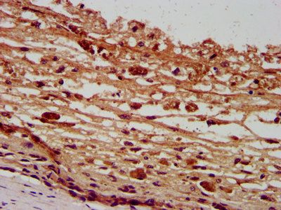PANX2 Antibody