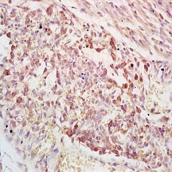 PAPPA Rabbit Polyclonal Antibody