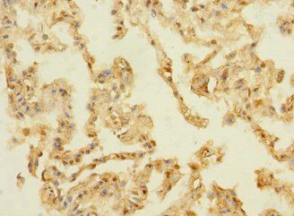 PAQR5 antibody