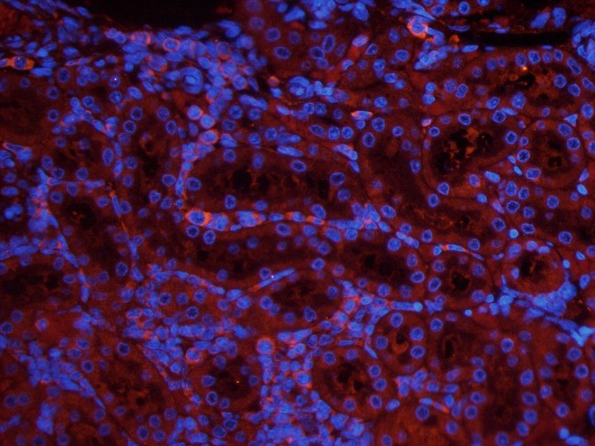 PAR2 Rabbit Polyclonal Antibody
