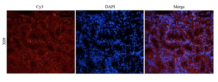 PAR2 antibody