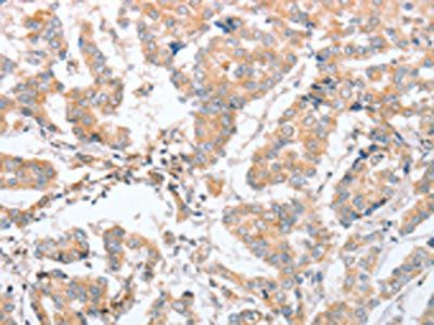 PARD6A Antibody