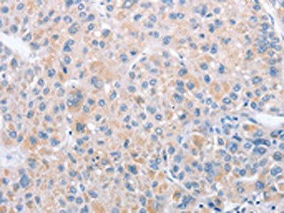 PARD6A Antibody