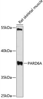 PAR6 antibody