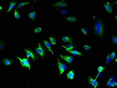 Parathyroid hormone 2 R antibody