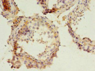PARD3 Antibody