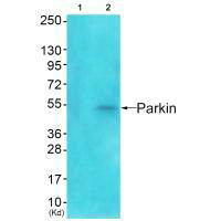 PARK2 antibody
