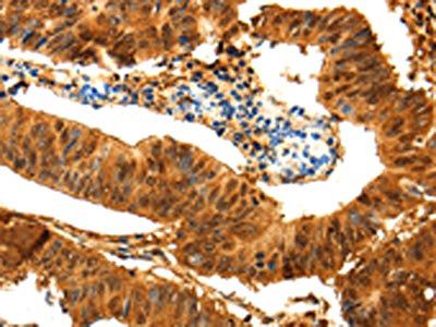 PARK7 Antibody