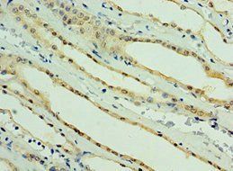 PARL Antibody