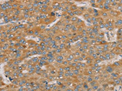PARL Antibody