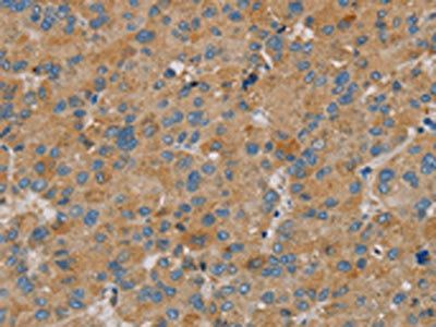 PARL Antibody