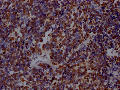 PARP1 Recombinant Monoclonal Antibody