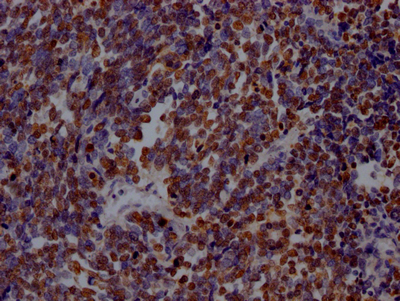 PARP1 antibody