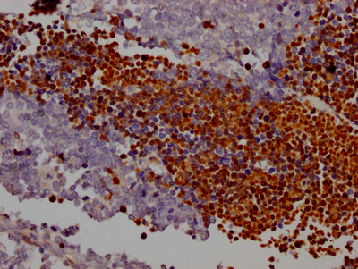 PARP1 Recombinant Monoclonal Antibody
