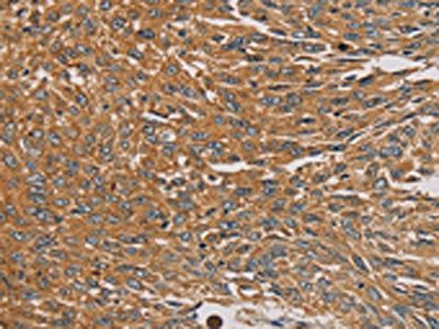 PARP11 Antibody