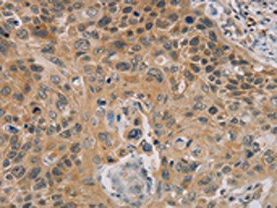 PARP11 Antibody