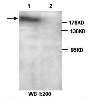 PARP14 Rabbit Polyclonal Antibody