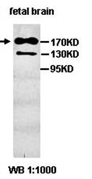 PARP14 antibody