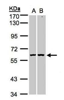 PARP3 antibody