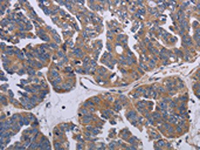 PARP4 Antibody
