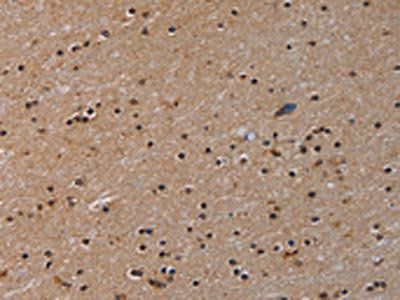 PARP8 Antibody