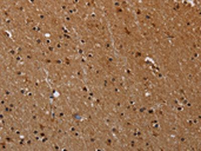 PARP8 Antibody