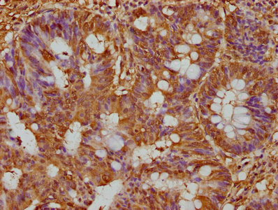 PARP8 Antibody
