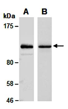 PARP (N) Antibody, Rabbit Polyclonal