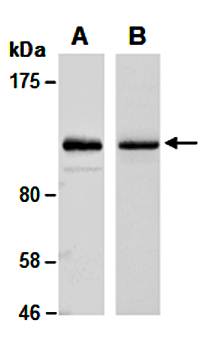 PARP (M) Antibody, Rabbit Polyclonal