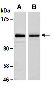 PARP (vPairTM) Antibodies