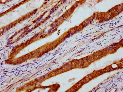 PARS2 Antibody